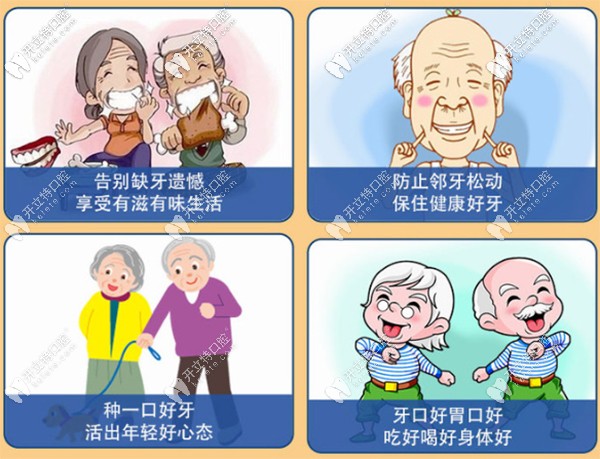 美國進口種植牙具有長久保持、堅固耐用的優(yōu)點