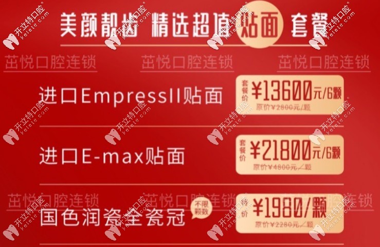 牙貼面價格