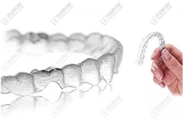 無托槽隱形牙套