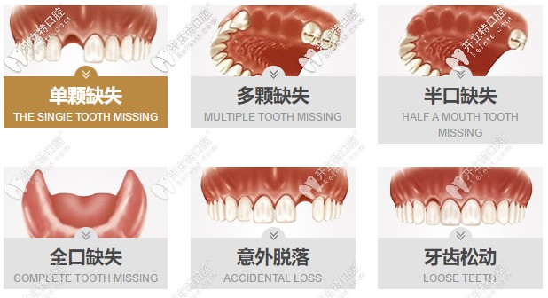找這份合肥貝杰口腔做種植牙的價(jià)格表不容易，請(qǐng)珍惜~