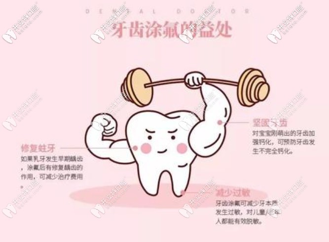 全口涂氟