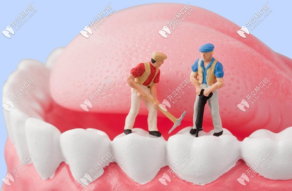 陽泉康貝齒科的牙齒修復(fù)價(jià)格