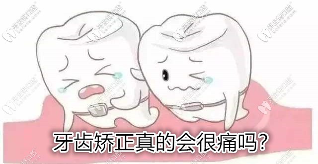 你知道矯正牙齒的痛算幾級疼痛嗎?來看看整牙哪步較疼吧！