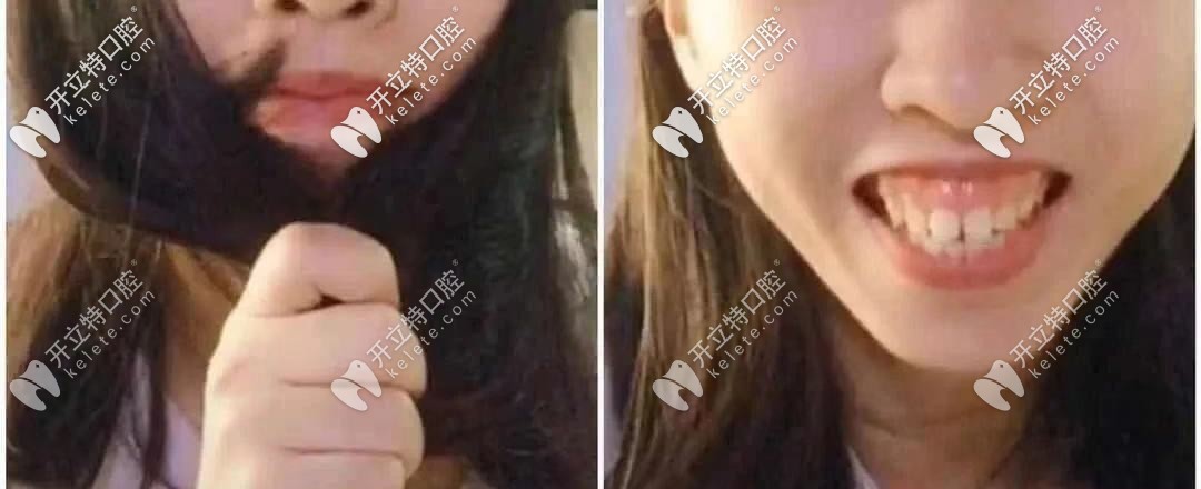 顏值是否也被封??？