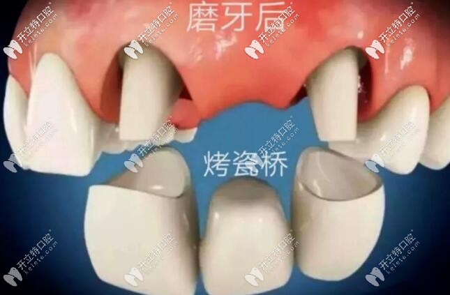 連橋冠