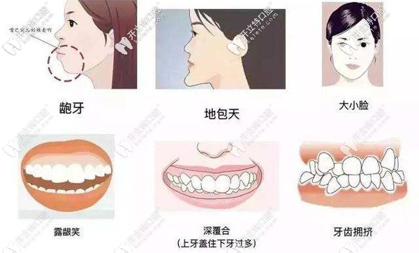 你是否有地包天、虎牙、齙牙、牙列不齊等牙齒問題