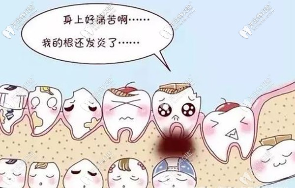 再和你聊聊發(fā)炎和干槽癥的區(qū)別？干槽癥前兆是啥樣？