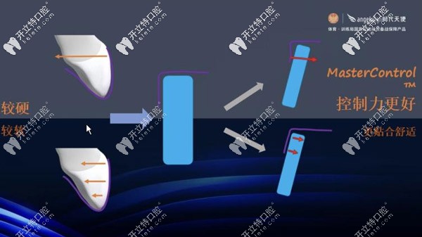 抗蠕變性強的材料，可以更加的控制牙齒
