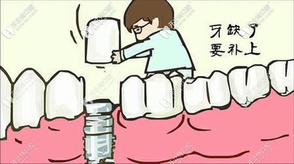 進(jìn)口種植牙價格