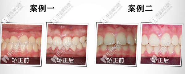 重慶團圓私立口腔醫(yī)院到底好不好？是連鎖牙科么？