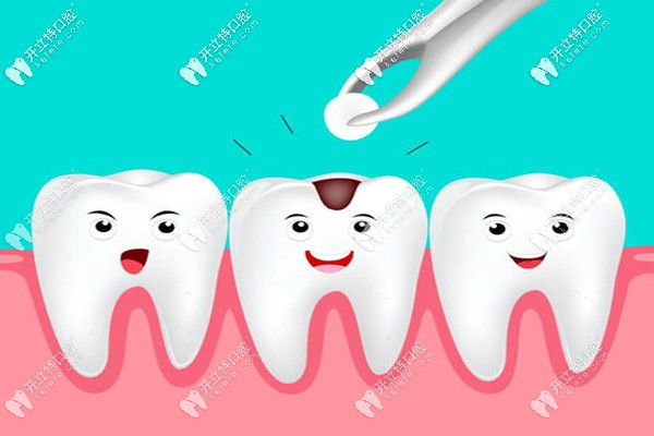 玉林口腔醫(yī)院補(bǔ)牙價格表