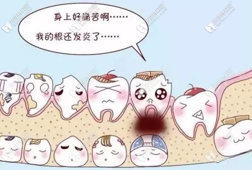 牙疼怎么辦，快來救救我！