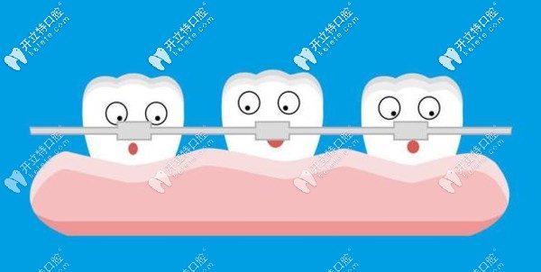 南京博韻口腔牙齒矯正價格