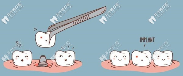 銀川和仁堂牙科醫(yī)院種植牙收費(fèi)標(biāo)準(zhǔn)