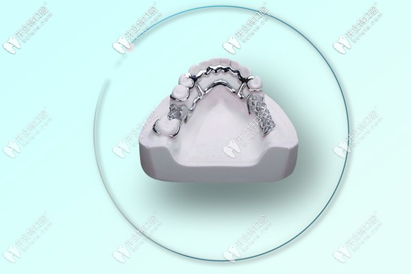 3d打印純鈦牙支架好嗎