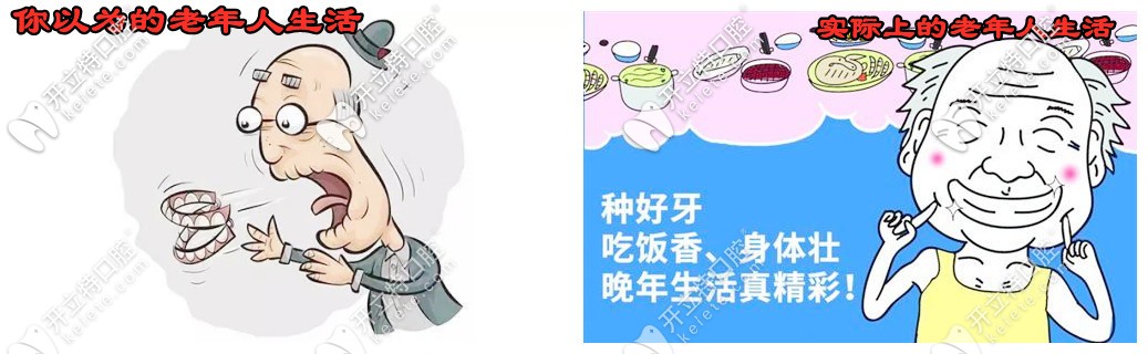 老人掉了很多牙怎么辦？看58歲楊女士的種牙體驗(yàn)