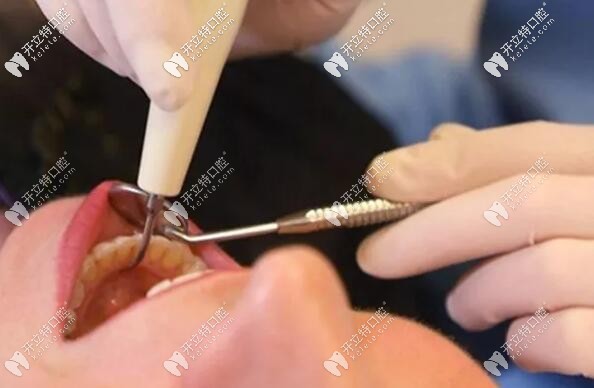 有高血壓、糖尿病等病史的能拔牙嗎