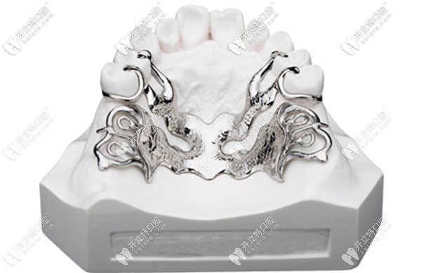 純鈦支架和諾必靈支架哪個好