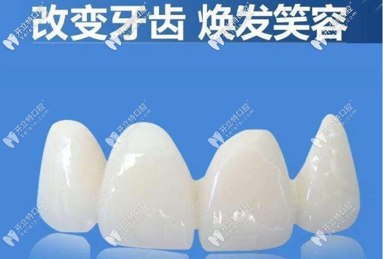前牙修復