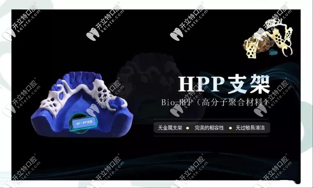 這有德國義齒品牌—hpp支架義齒的優(yōu)缺點和價格介紹