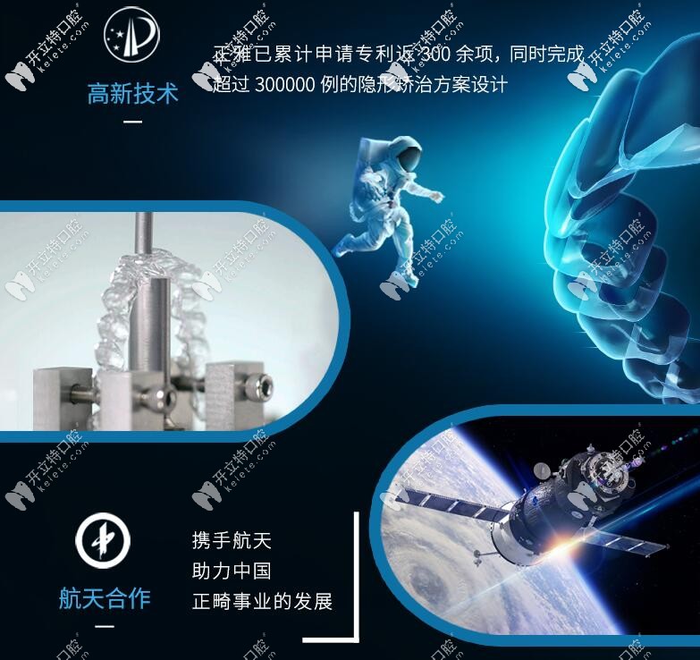 國產(chǎn)正雅牙套是航天局合作伙伴