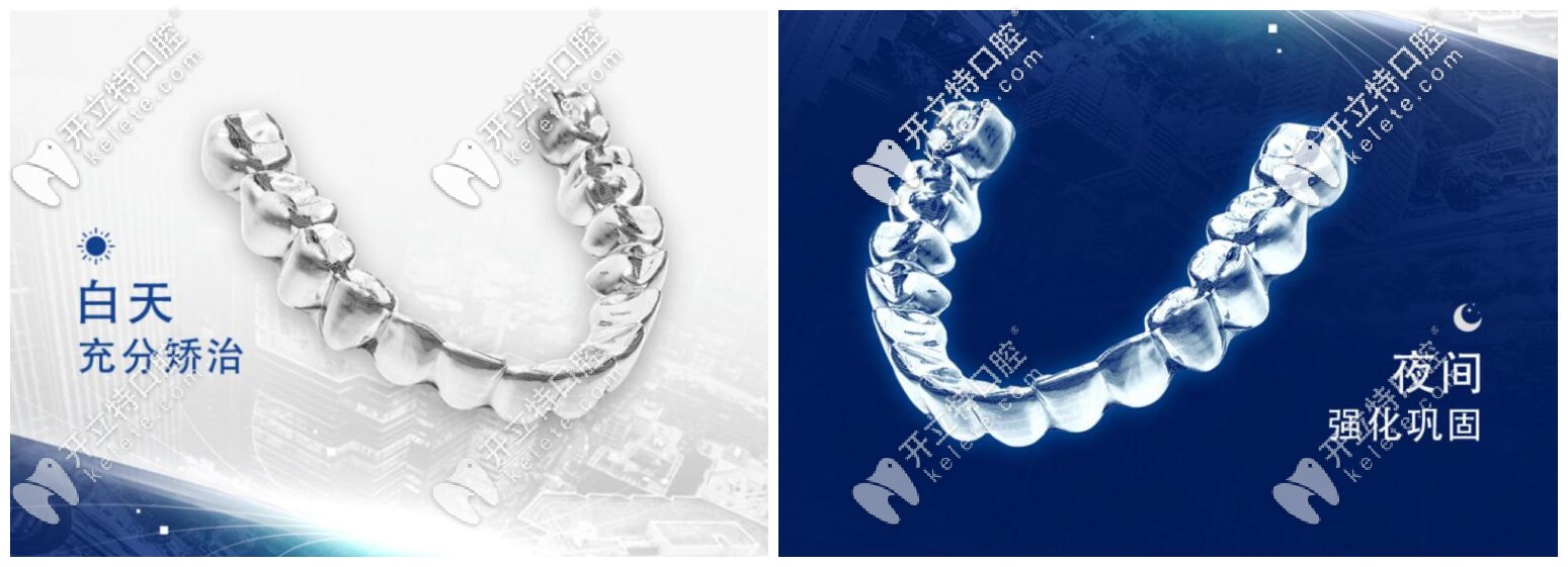 正雅日夜版雙膜隱形牙套效果怎么樣？入手價(jià)格大概是多少