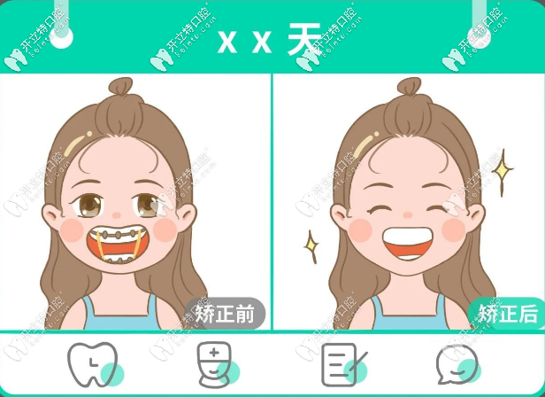 在揭陽做牙齒矯正的價格