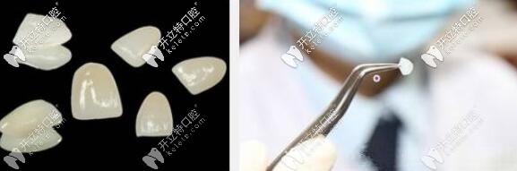 瓷貼面種類(lèi)大全