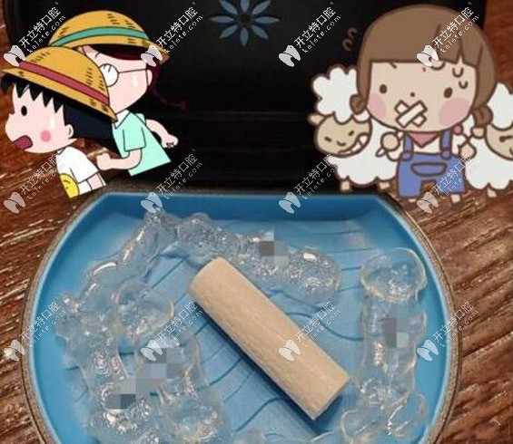 隱適美矯正器