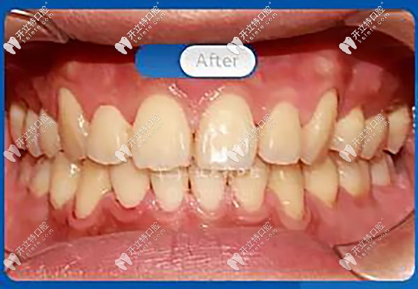 笑容自信陽光有感染力