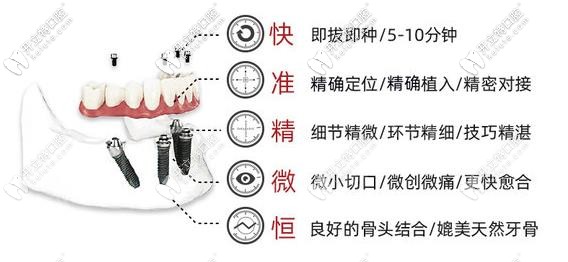 即刻種植、即刻負重技術優(yōu)勢