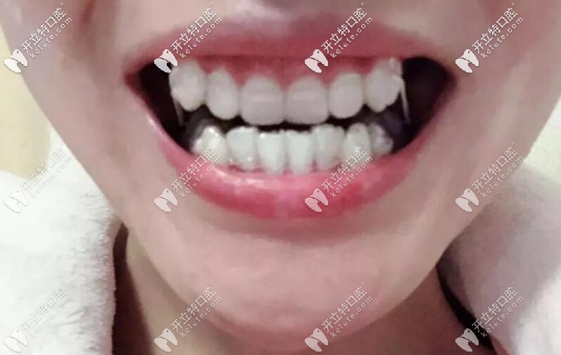 皮筋套