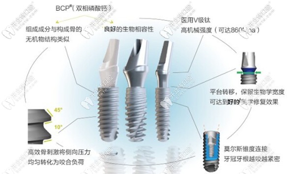 法國安卓健種植牙的優(yōu)勢