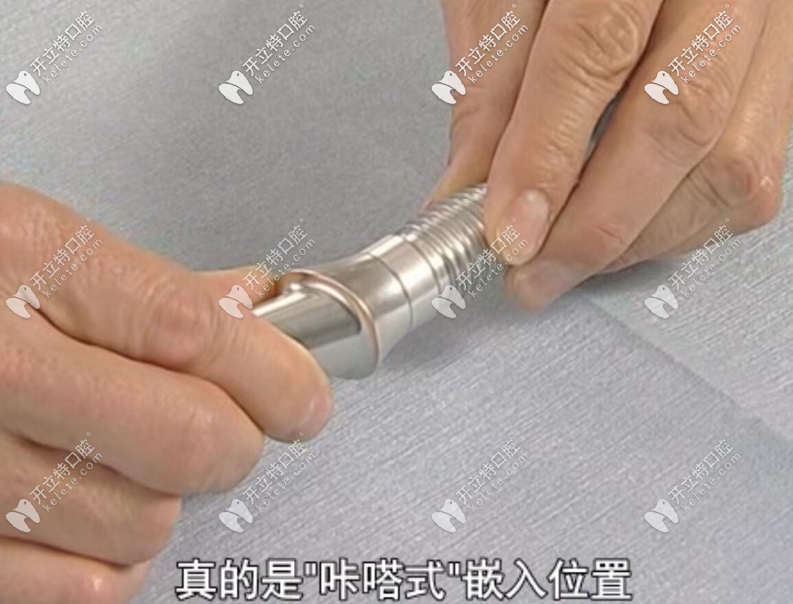 植體和基臺(tái)連接演示