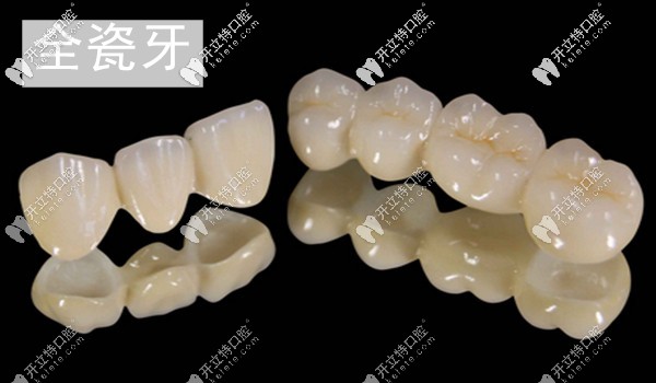 深圳正夫口腔愛爾創(chuàng)全瓷牙冠多少錢