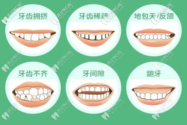 深圳正夫口腔牙齒矯正的費用