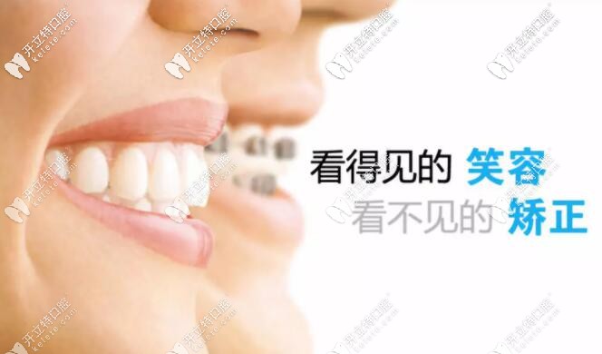 塑料牙套能矯正牙齒嗎?正畸效果好不好呀