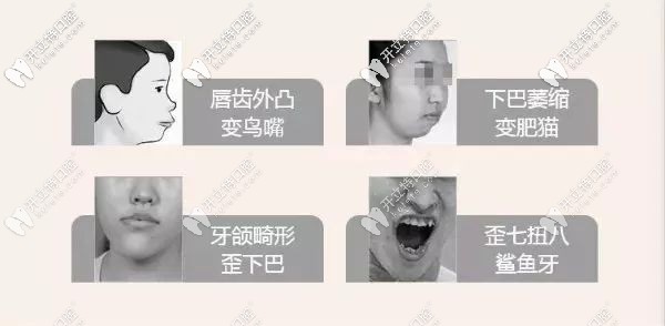 兒童牙齒早期干預(yù)適應(yīng)癥