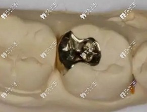 醫(yī)生技術(shù)不豐富，材料填充不嚴(yán)密