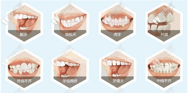 蕪湖矯正牙齒哪家好，這整牙正規(guī)的蕪湖牙科醫(yī)院排名得看