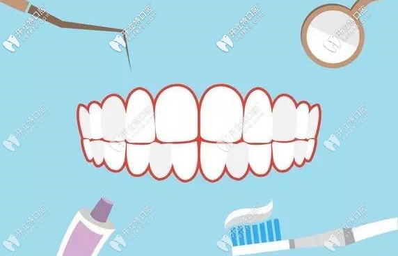 洗牙的第4等級為牙周維護(hù)治療