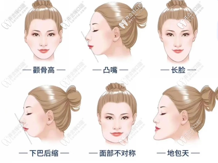 牙齒矯正適應性