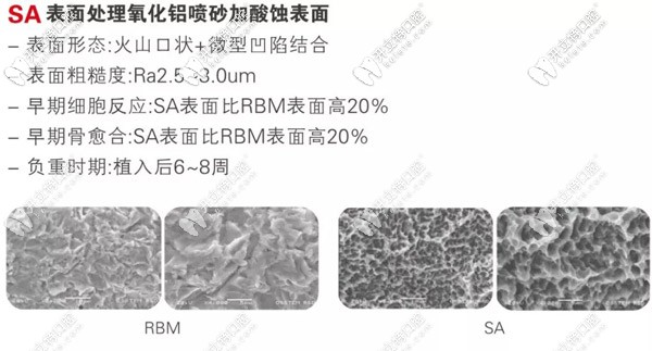 奧齒泰SA種植系統(tǒng)縮短了植入的時(shí)間