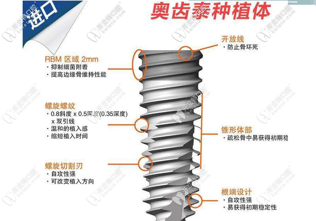 來(lái)看看奧齒泰種植體怎么樣