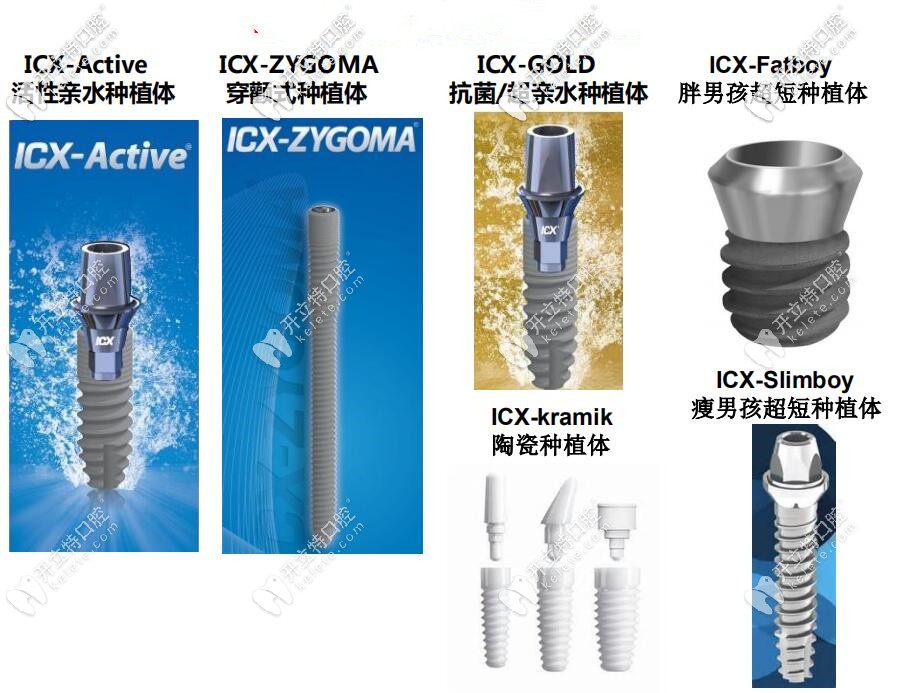 ixc種植體型號(hào)表_圖源kelete.com