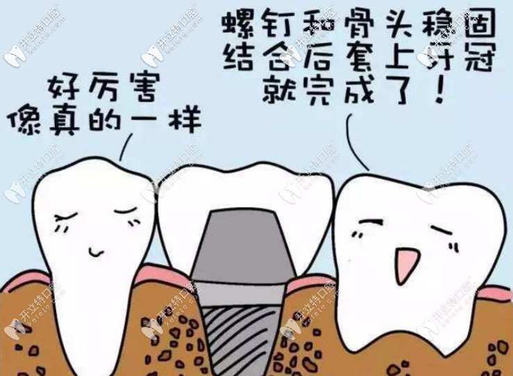 種植牙
