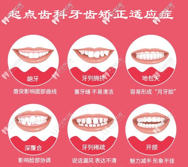 深圳起點口腔牙齒矯正多少錢