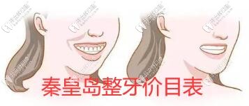 來一份秦皇島整牙價(jià)目表,看看各口腔醫(yī)院收費(fèi)標(biāo)準(zhǔn)是怎樣的