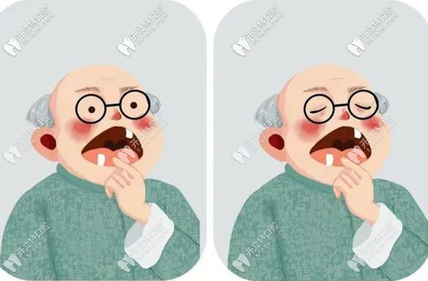 試問種植牙咀嚼功能怎么樣,和自己的真牙咀嚼效率一樣嗎？