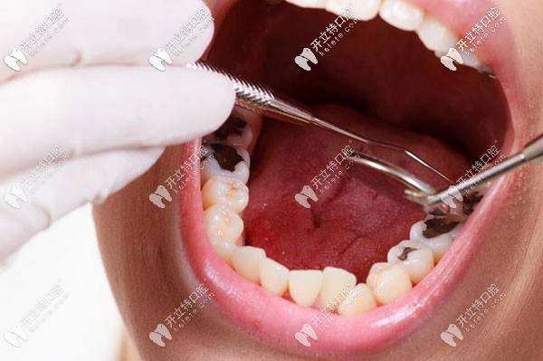 牙齒疾病在口腔科如何掛號(hào)